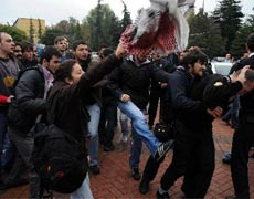 Trabzon halkını çıldırtacak sözler